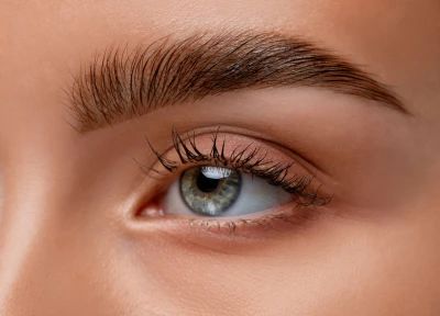 Browlift